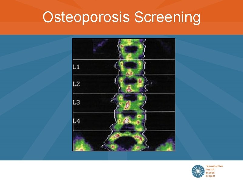 Osteoporosis Screening 