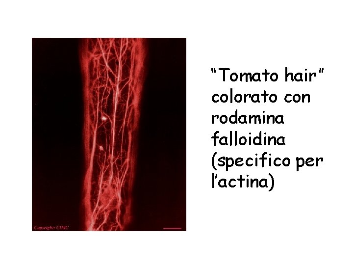 “Tomato hair” colorato con rodamina falloidina (specifico per l’actina) 