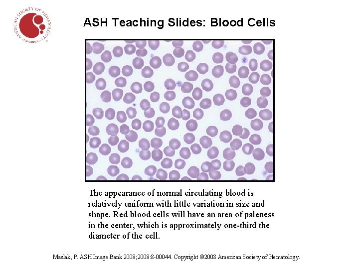 ASH Teaching Slides: Blood Cells The appearance of normal circulating blood is relatively uniform