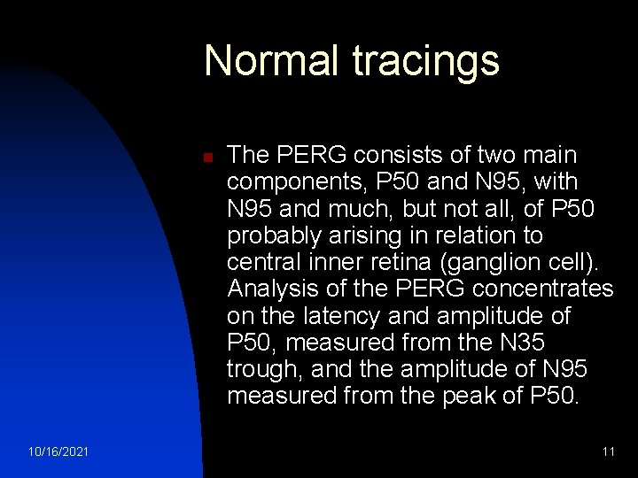 Normal tracings n 10/16/2021 The PERG consists of two main components, P 50 and
