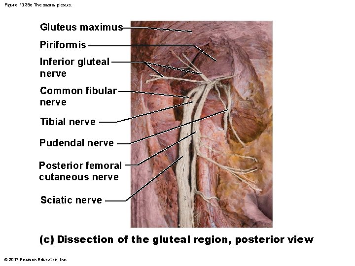Figure 13. 38 c The sacral plexus. Gluteus maximus Piriformis Inferior gluteal nerve Common