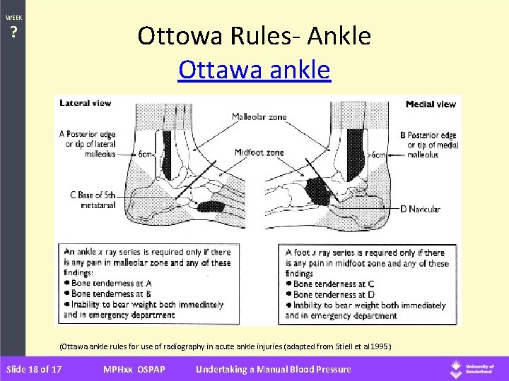 WEEK Ottowa Rules- Ankle Ottawa ankle ? (Ottawa ankle rules for use of radiography