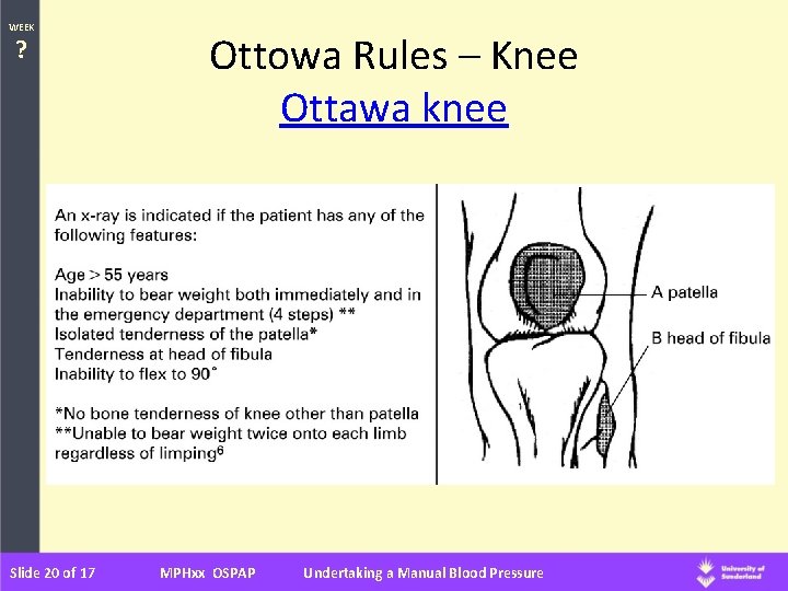 WEEK ? Slide 20 of 17 Ottowa Rules – Knee Ottawa knee MPHxx OSPAP