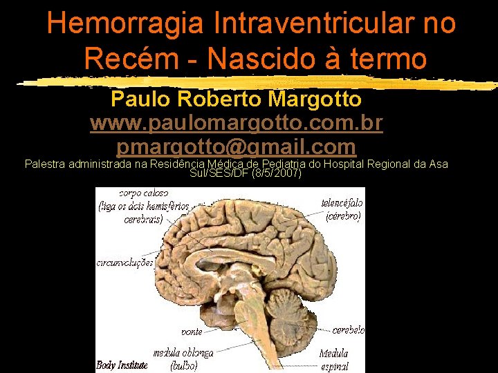Hemorragia Intraventricular no Recém - Nascido à termo Paulo Roberto Margotto www. paulomargotto. com.