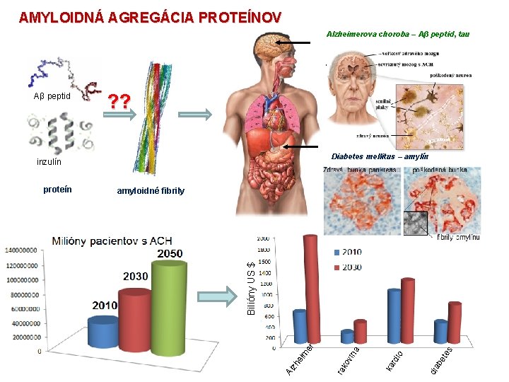 AMYLOIDNÁ AGREGÁCIA PROTEÍNOV Alzheimerova choroba – Aβ peptid, tau Parkinsonova choroba – α-synukleín Priónové