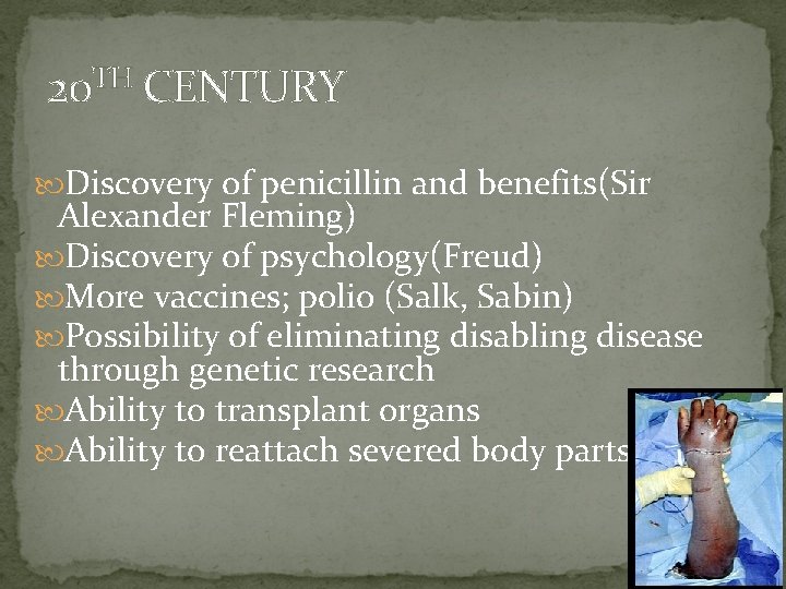 20 TH CENTURY Discovery of penicillin and benefits(Sir Alexander Fleming) Discovery of psychology(Freud) More