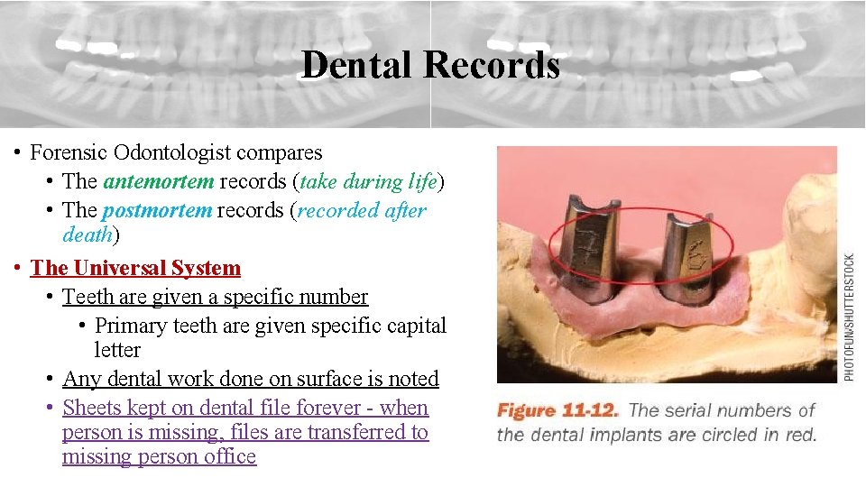 Dental Records • Forensic Odontologist compares • The antemortem records (take during life) •