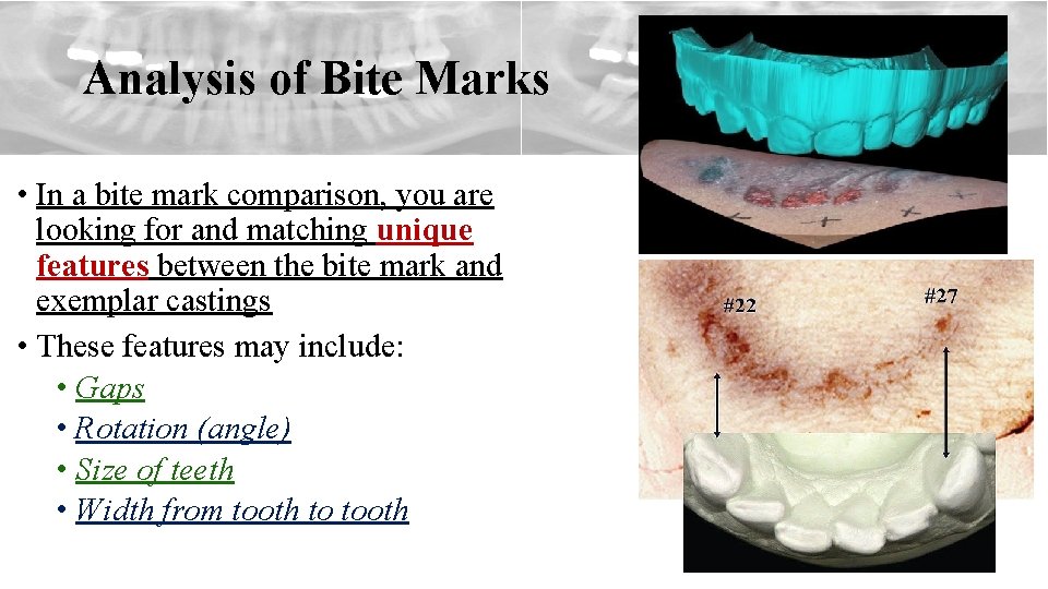 Analysis of Bite Marks • In a bite mark comparison, you are looking for