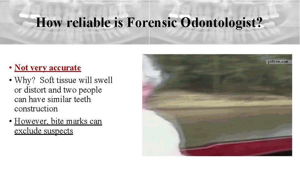 How reliable is Forensic Odontologist? • Not very accurate • Why? Soft tissue will