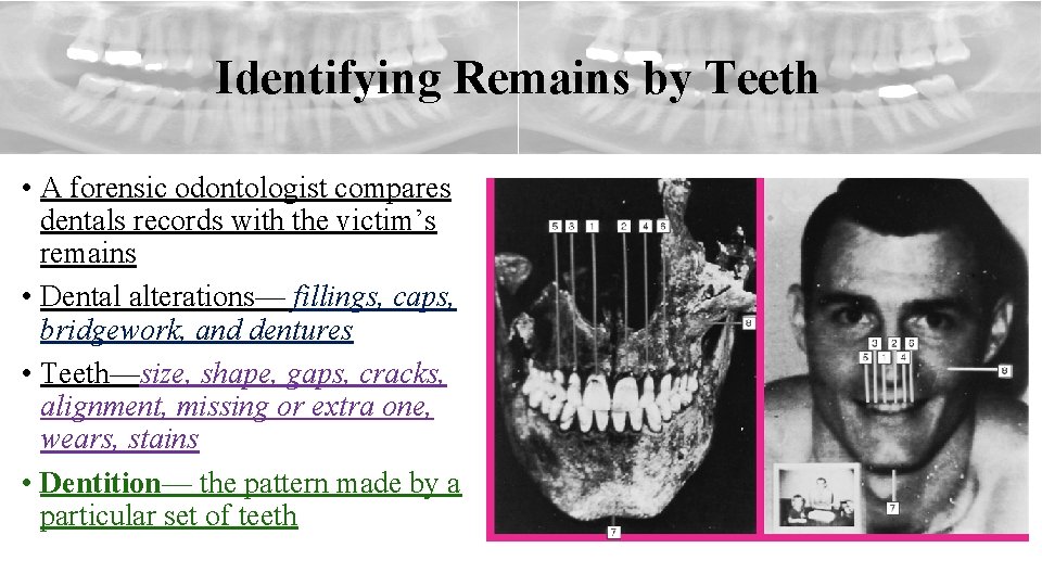 Identifying Remains by Teeth • A forensic odontologist compares dentals records with the victim’s