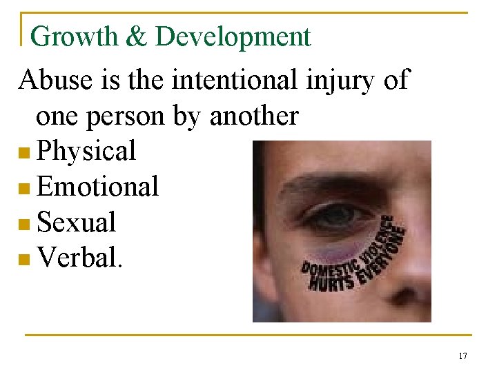 Growth & Development Abuse is the intentional injury of one person by another n