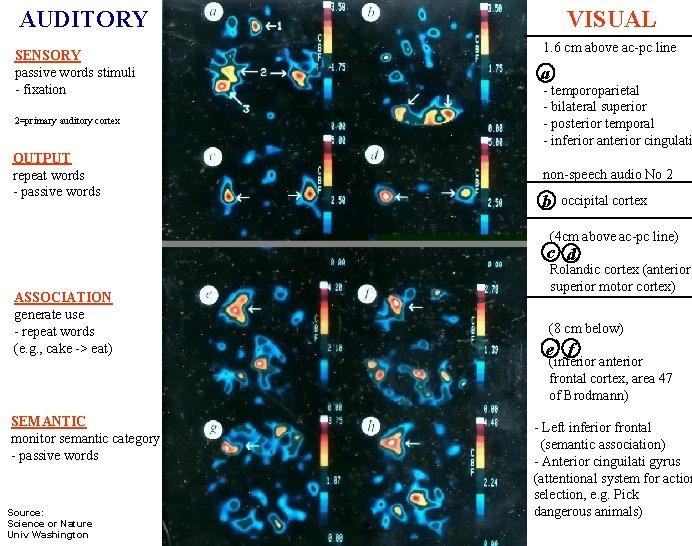 AUDITORY SENSORY passive words stimuli - fixation 2=primary auditory cortex OUTPUT repeat words - AUDITORY SENSORY passive words stimuli - fixation 2=primary auditory cortex OUTPUT repeat words -