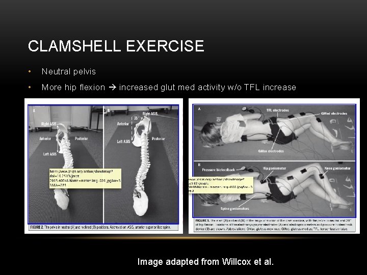 CLAMSHELL EXERCISE • Neutral pelvis • More hip flexion increased glut med activity w/o