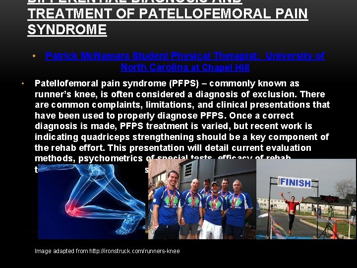 DIFFERENTIAL DIAGNOSIS AND TREATMENT OF PATELLOFEMORAL PAIN SYNDROME • • Patrick Mc. Namara Student