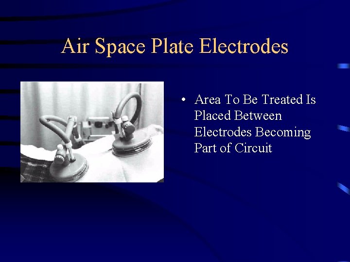 Air Space Plate Electrodes • Area To Be Treated Is Placed Between Electrodes Becoming