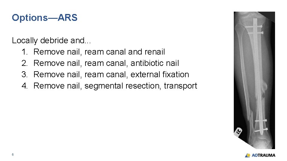 Options—ARS Locally debride and. . . 1. Remove nail, ream canal and renail 2.