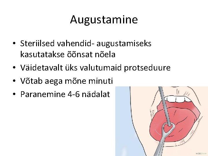 Augustamine • Steriilsed vahendid- augustamiseks kasutatakse õõnsat nõela • Väidetavalt üks valutumaid protseduure •