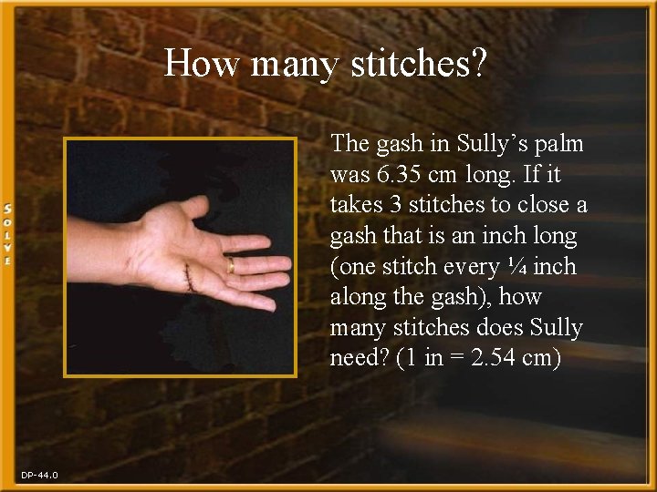 How many stitches? The gash in Sully’s palm was 6. 35 cm long. If