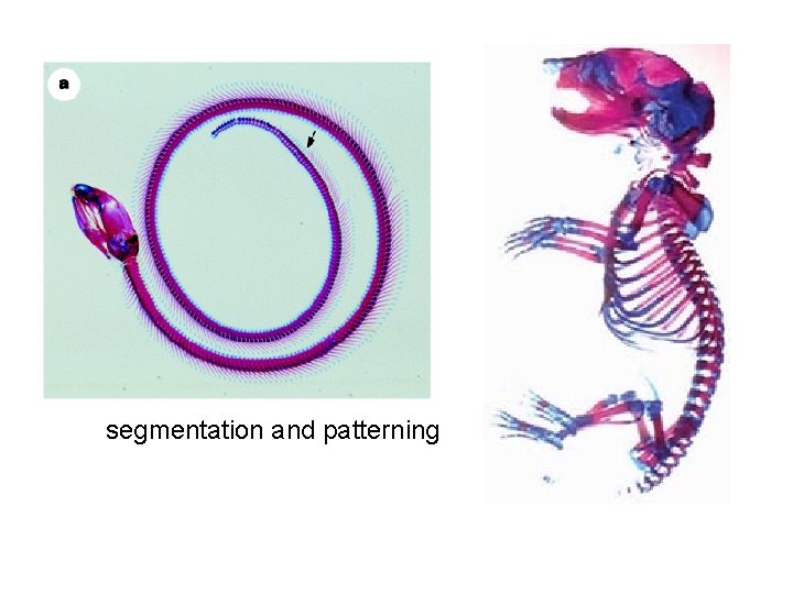 segmentation and patterning 