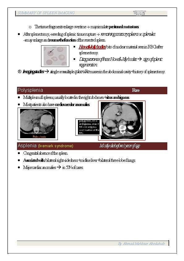 SUMMARY OF SPLEEN IMAGING o Thetissuefragmentsenlargeovertime maysimulateperitonealmetastases. Aftersplenectomy, seedingofsplenic tissuerupture remainingaccessoryspleensor splenules mayenlargeandresumethefunctionoftheresected spleen.