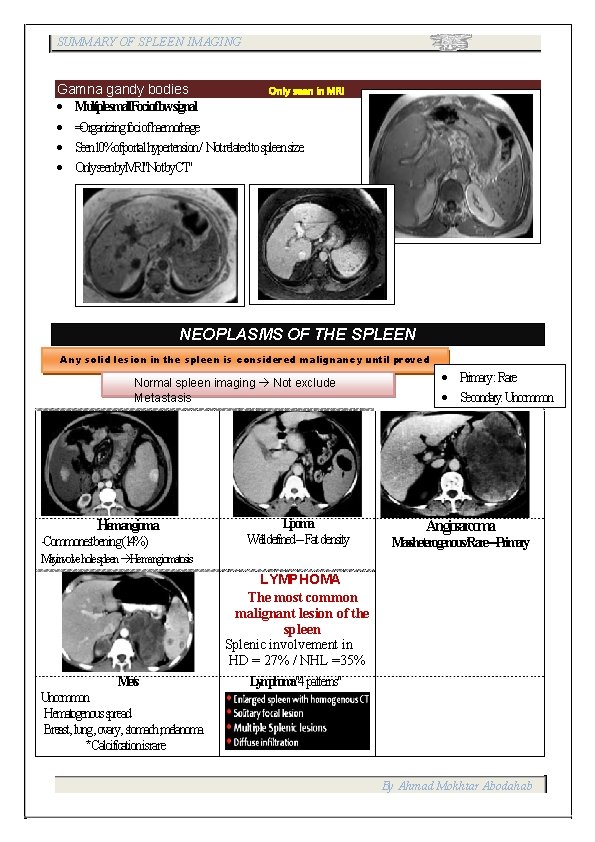 SUMMARY OF SPLEEN IMAGING Gamna gandy bodies Only seen in MRI Multiplesmall. Focioflowsignal =Organizingfociofhaemorhage