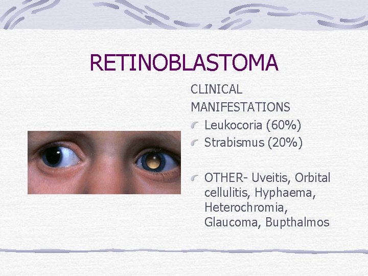 RETINOBLASTOMA CLINICAL MANIFESTATIONS Leukocoria (60%) Strabismus (20%) OTHER- Uveitis, Orbital cellulitis, Hyphaema, Heterochromia, Glaucoma,