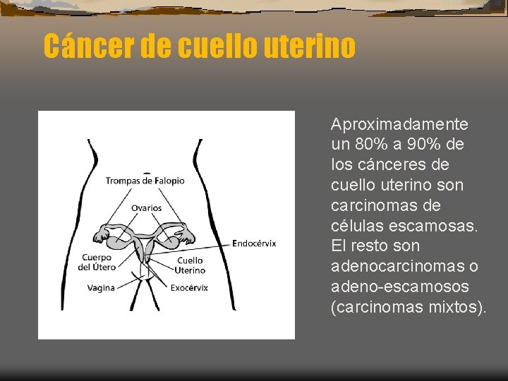 Cáncer de cuello uterino Aproximadamente un 80% a 90% de los cánceres de cuello