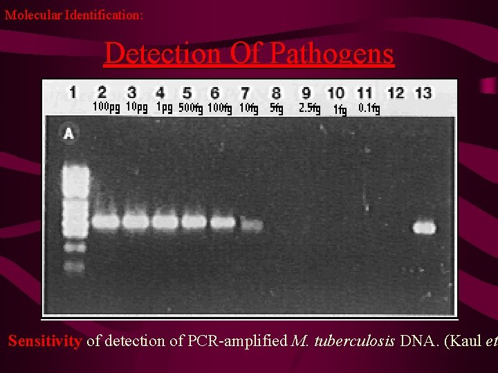 Molecular Identification: Detection Of Pathogens Sensitivity of detection of PCR-amplified M. tuberculosis DNA. (Kaul
