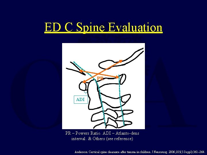 ED C Spine Evaluation PR ADI PR – Powers Ratio. ADI – Atlanto-dens interval.