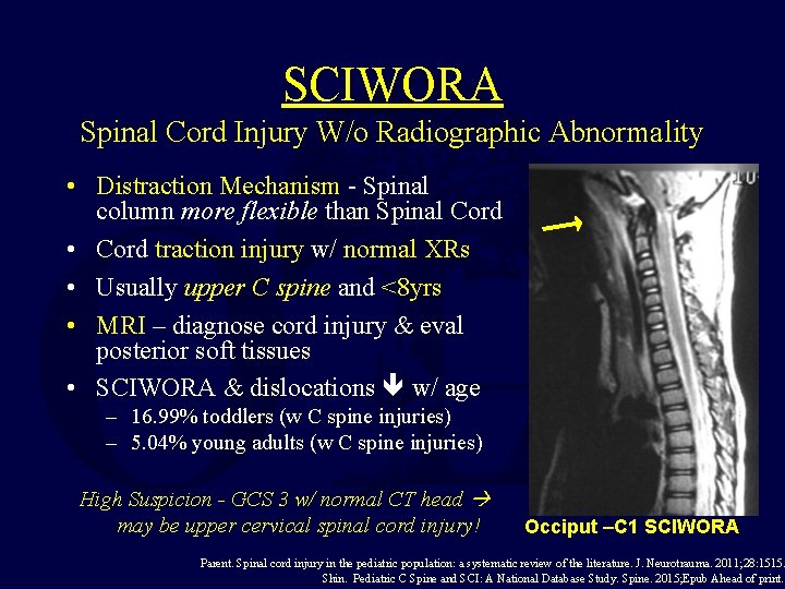 SCIWORA Spinal Cord Injury W/o Radiographic Abnormality • Distraction Mechanism - Spinal column more