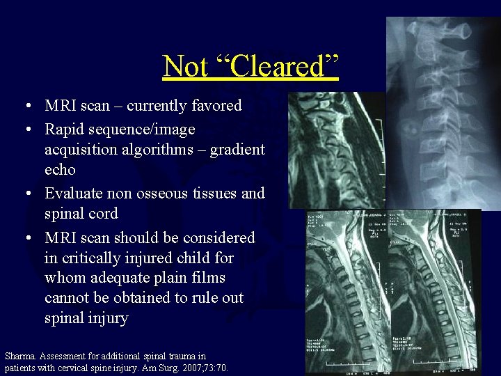 Not “Cleared” • MRI scan – currently favored • Rapid sequence/image acquisition algorithms –