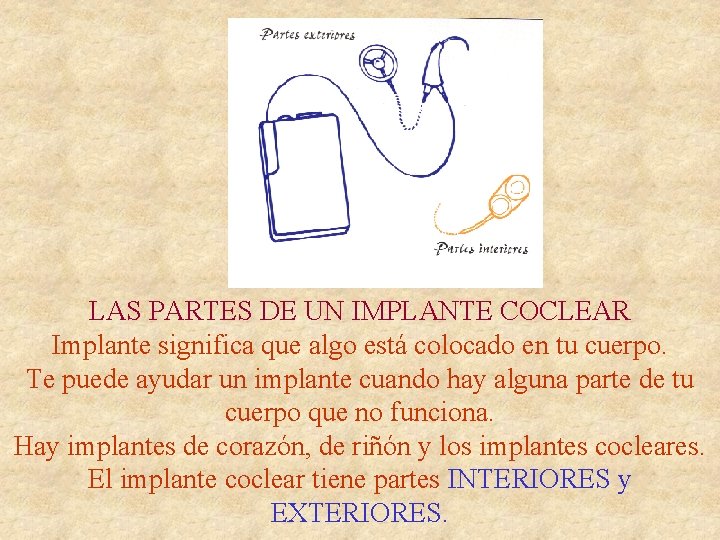 LAS PARTES DE UN IMPLANTE COCLEAR Implante significa que algo está colocado en tu