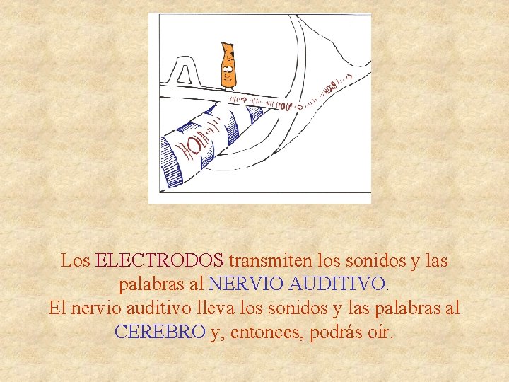 Los ELECTRODOS transmiten los sonidos y las palabras al NERVIO AUDITIVO. El nervio auditivo