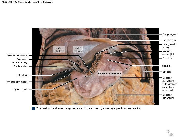 Figure 24– 12 a Gross Anatomy of the Stomach. Esophagus Diaphragm Liver, right lobe