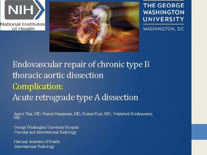 Endovascular repair of chronic type B thoracic aortic