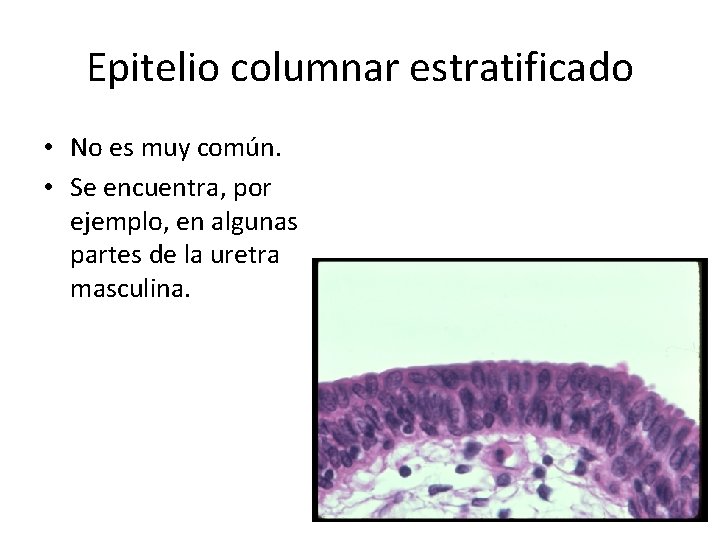 Epitelio columnar estratificado • No es muy común. • Se encuentra, por ejemplo, en