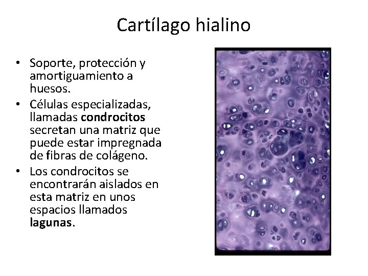 Cartílago hialino • Soporte, protección y amortiguamiento a huesos. • Células especializadas, llamadas condrocitos