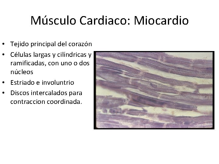 Músculo Cardiaco: Miocardio • Tejido principal del corazón • Células largas y cilíndricas y