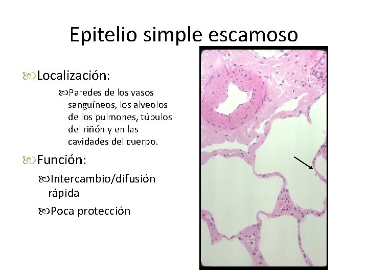 Epitelio simple escamoso Localización: Paredes de los vasos sanguíneos, los alveolos de los pulmones,