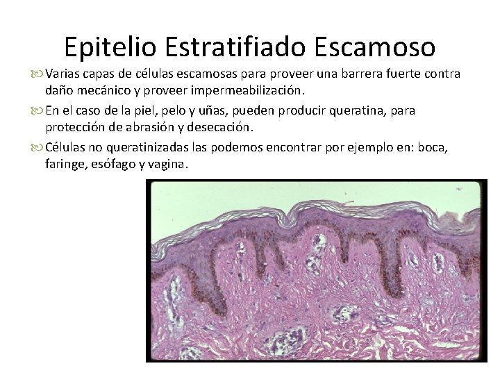 Epitelio Estratifiado Escamoso Varias capas de células escamosas para proveer una barrera fuerte contra