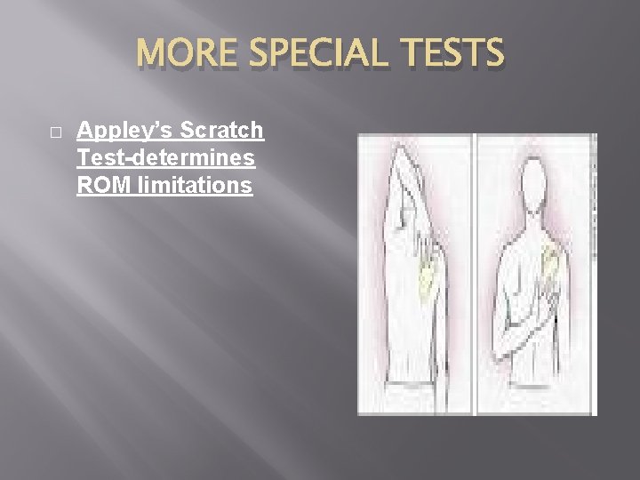 MORE SPECIAL TESTS � Appley’s Scratch Test-determines ROM limitations 