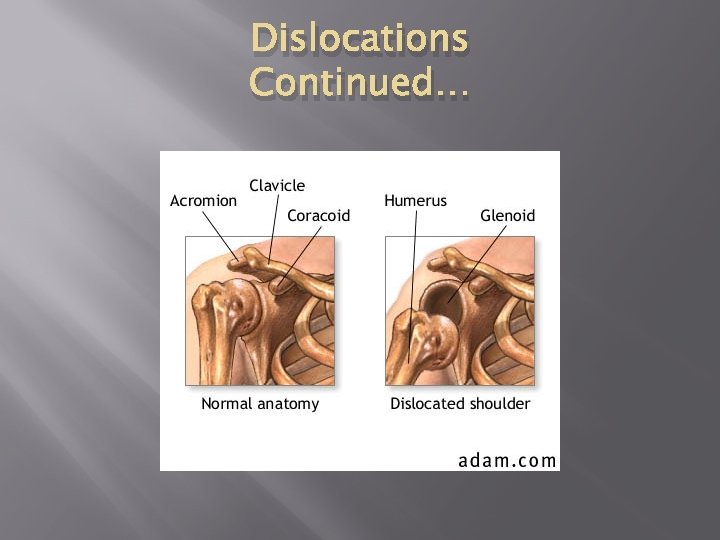 Dislocations Continued… 