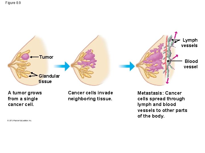Figure 8. 9 Lymph vessels Tumor Blood vessel Glandular tissue A tumor grows from