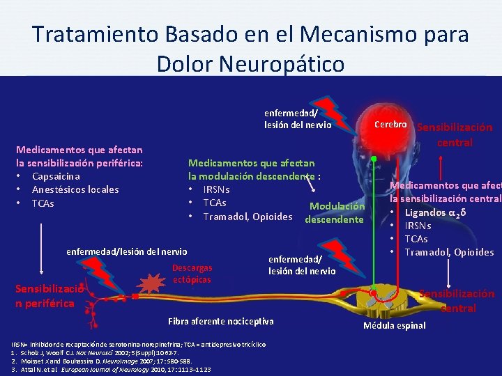 Tratamiento Basado en el Mecanismo para Dolor Neuropático enfermedad/ lesión del nervio Medicamentos que