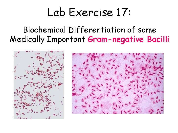 Lab Exercise 17: Biochemical Differentiation of some Medically Important Gram-negative Bacilli 