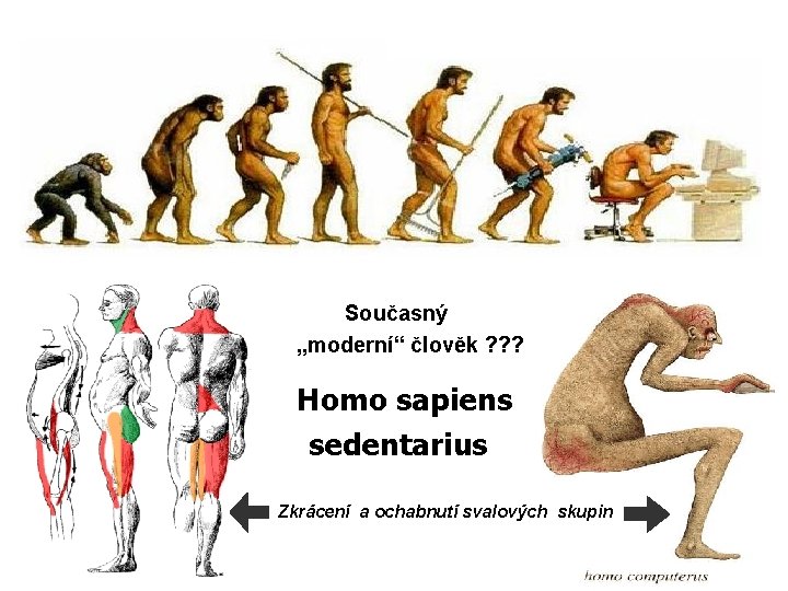 Současný „moderní“ člověk ? ? ? Homo sapiens sedentarius Zkrácení a ochabnutí svalových skupin