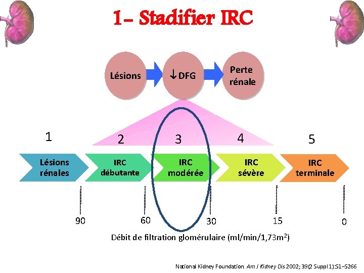 1 - Stadifier IRC Lésions 1 2 Lésions rénales 4 3 IRC modérée IRC