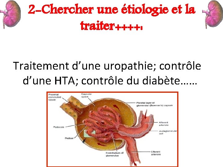 2 -Chercher une étiologie et la traiter++++: Traitement d’une uropathie; contrôle d’une HTA; contrôle