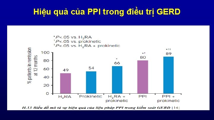 Hiệu quả của PPI trong điều trị GERD 