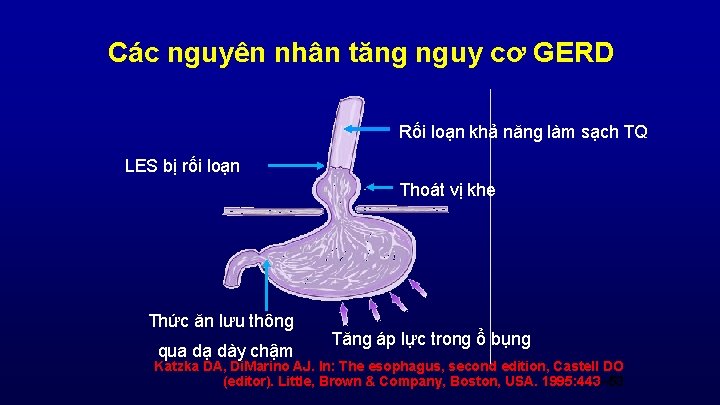 Các nguyên nhân tăng nguy cơ GERD Rối loạn khả năng làm sạch TQ